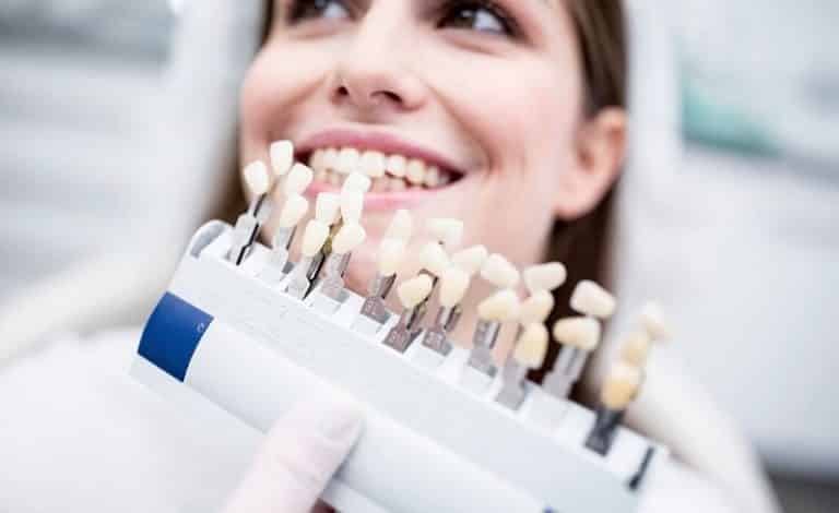 Ilustrasi veneer gigi yang bagus