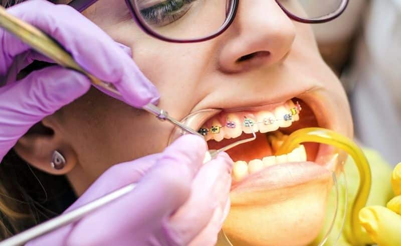Fantastis! Ini Perbedaan Orthodontist dengan Dokter Gigi Umum