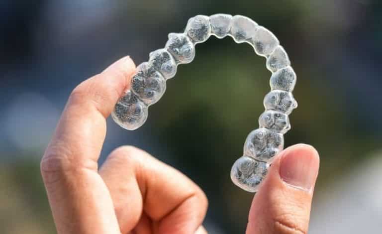 Retainer gigi transparan