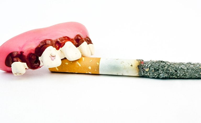 dampak gigi rusak karena rokok