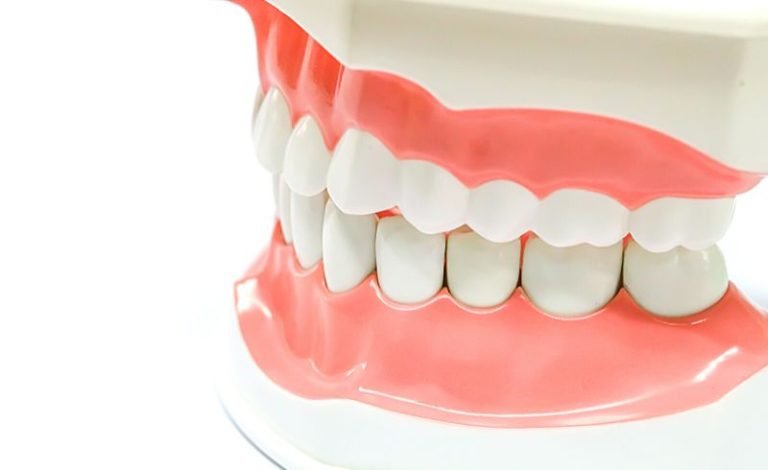 penyebab gusi berwarna hitam