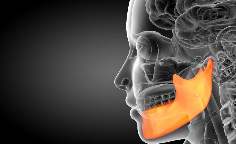 Beberapa contoh penyebab utama posisi rahang gigi bergeser