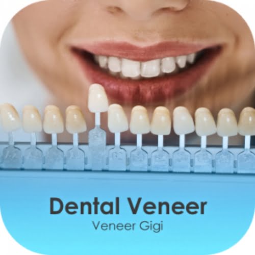 Layanan perawatan veneer gigi di klinik Axel Dental