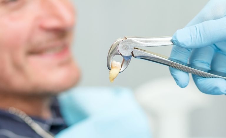 Biaya Cabut Gigi di Klinik Gigi