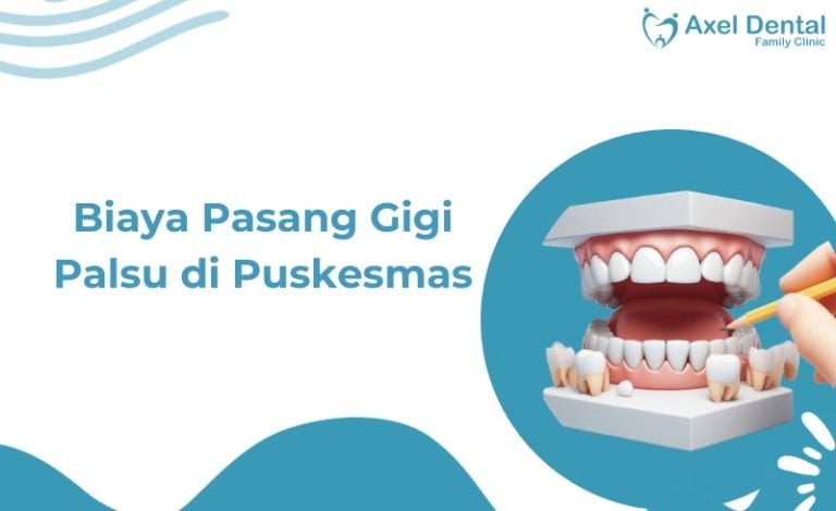 Harga Pasang Gigi Palsu di Puskesmas
