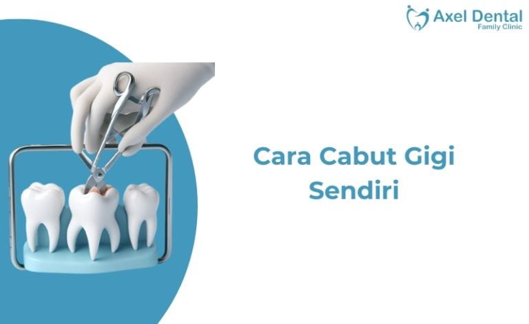 Cara Mencabut Gigi Sendiri