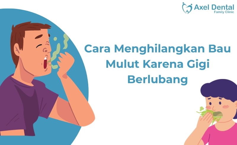 5 Cara Menghilangkan Bau Mulut Karena Gigi Berlubang