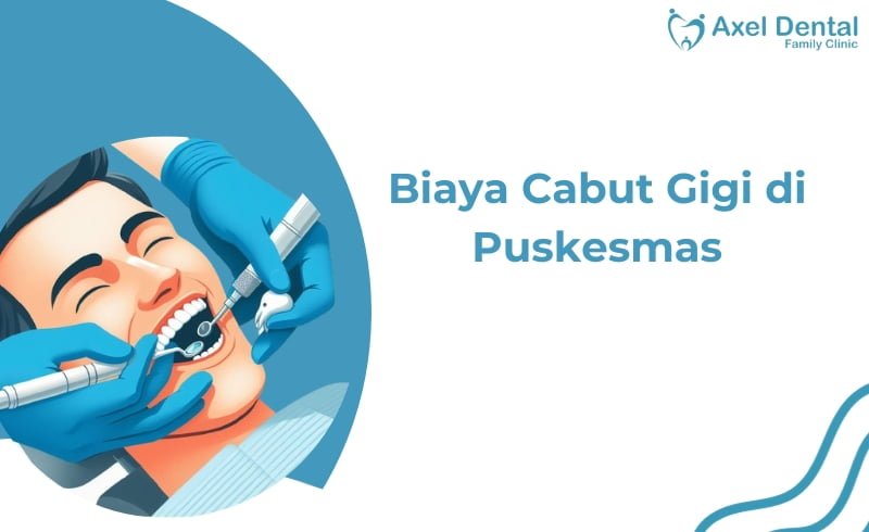 Biaya Cabut Gigi di Puskesmas BPJS,KIS & Non BPJS