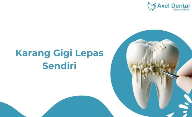 Karang Gigi Copot Sendiri