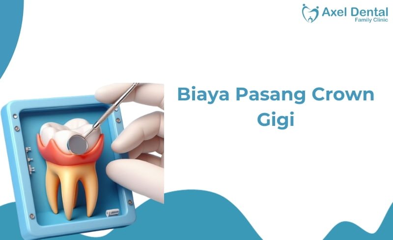 Biaya Pasang Crown Gigi di Klinik & Puskesmas