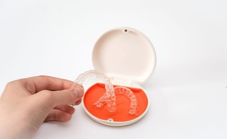 Clear Retainer: Jenis, Harga & Cara Merawatnya