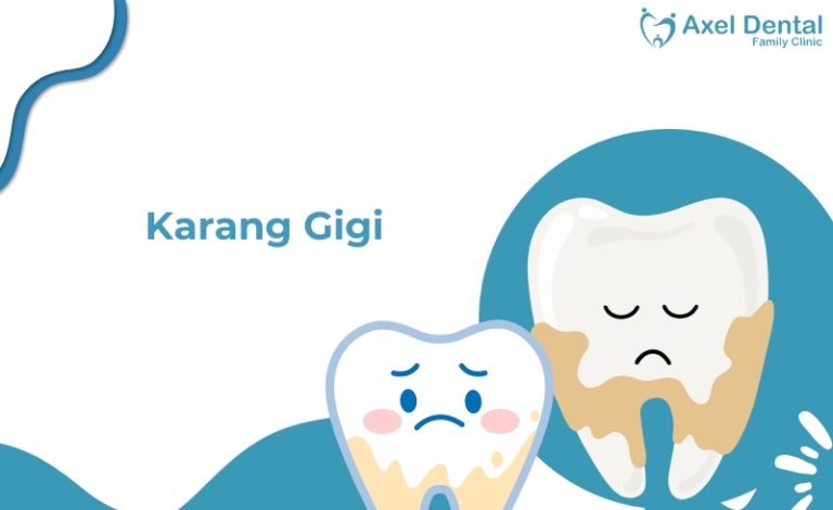 karang pada gigi
