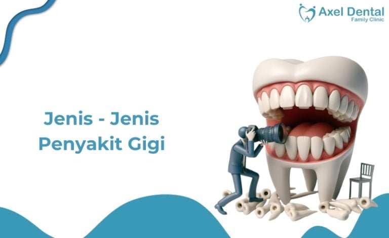 Jenis Penyakit Gigi