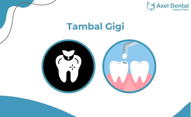 Tambal Gigi: Jenis, Efek Samping, Prosedur & Pantangannya