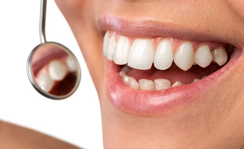 Efek samping gigi tonggos jika di biarkan