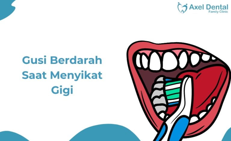 Gusi Berdarah Saat Gosok Gigi