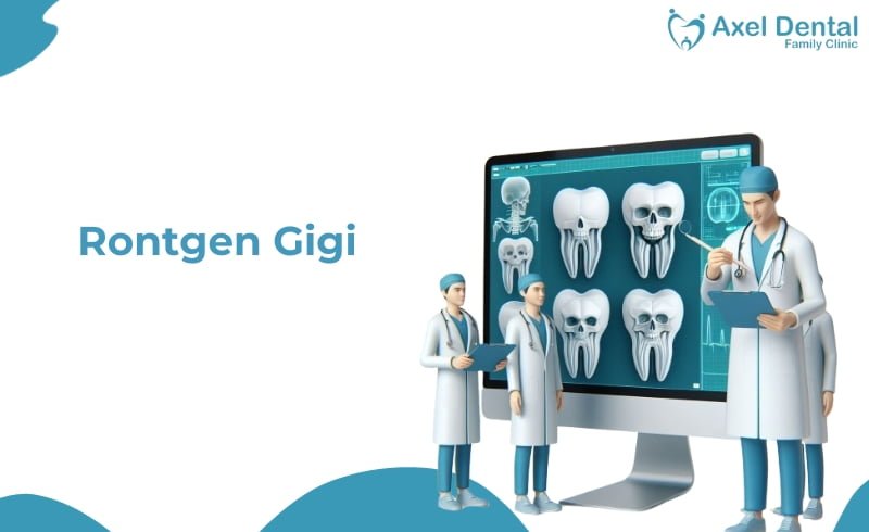 Rontgen Gigi: Definisi, Harga, Jenis dan Risikonya