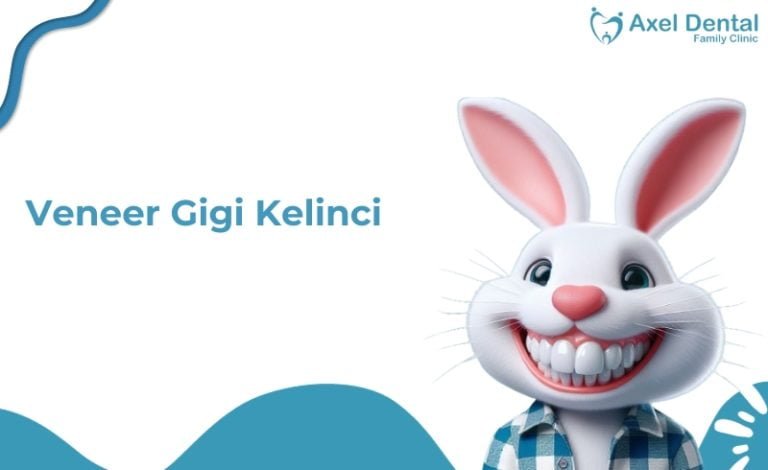 Veneer gigi kelinci pada manusia