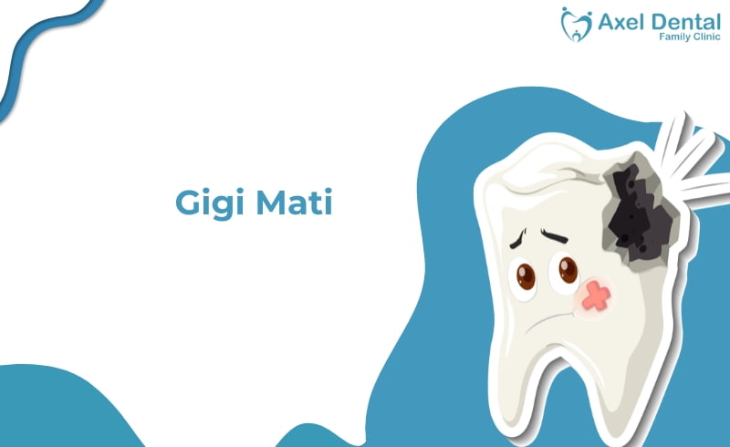 Gigi Mati, Bahaya Nih! Kapan Harus ke Dokter Gigi?