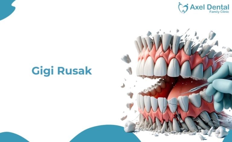 Gigi rusak pada manusia