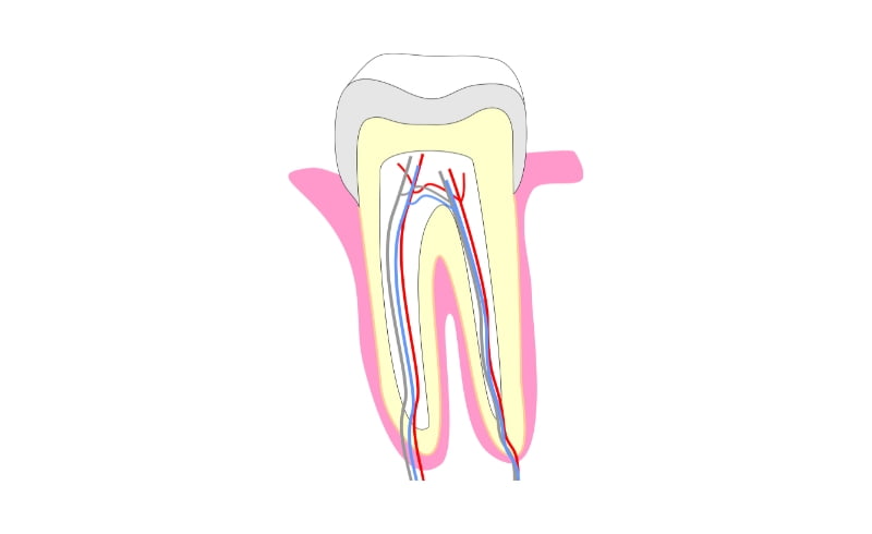 Jenis - jenis Masalah pada Dentin Gigi