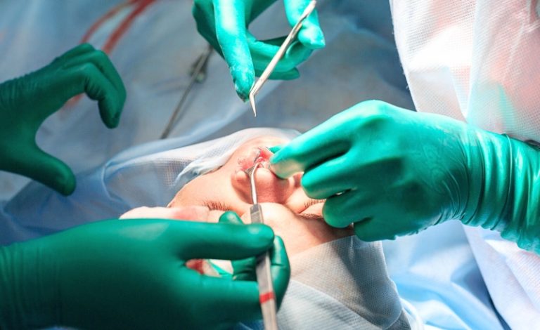 Gambar dokter yang menggunakan peralatan medis khusus sedang melakukan operasi gigi. Biaya bedah mulut bervariasi tergantung pada jenis prosedur, lokasi, dan tingkat keparahan