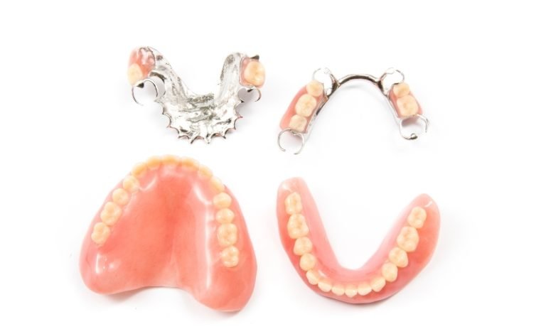 Gigi palsu lepasangan atas bawah dengan kerangka logam