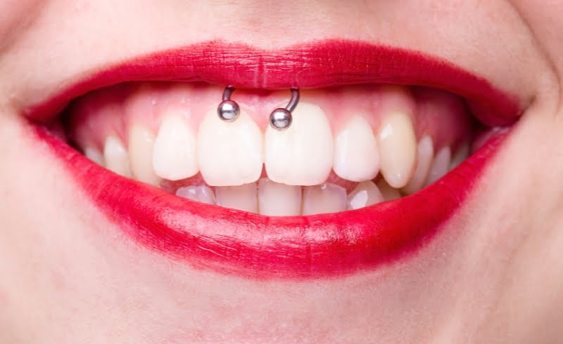 Seorang wanita menunjukkan tindik smiley di bagian mulutnya
