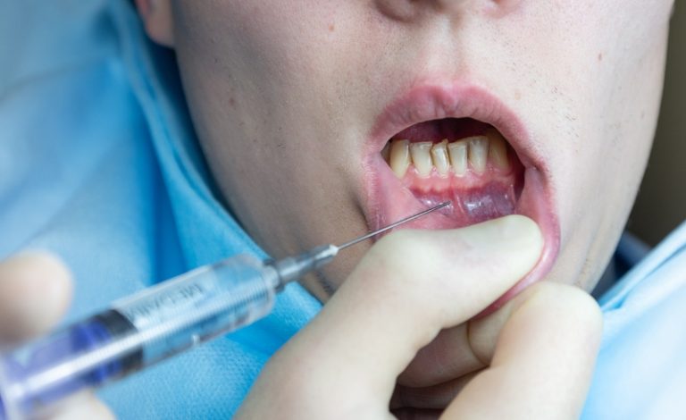 Dokter gigi sedang menyuntikkan anestesi gigi ke mulut pria tersebut