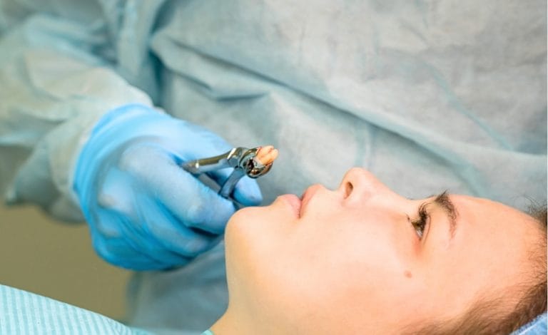 Dokter gigi mencabut gigi bungsu seorang wanita